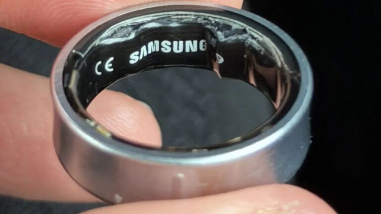 Владелец умного кольца Samsung Galaxy Ring попал в больницу из-за вздувшейся батареи
