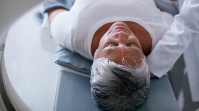 Ученые нашли способ предотвратить развитие болезни Альцгеймера на ранней стадии