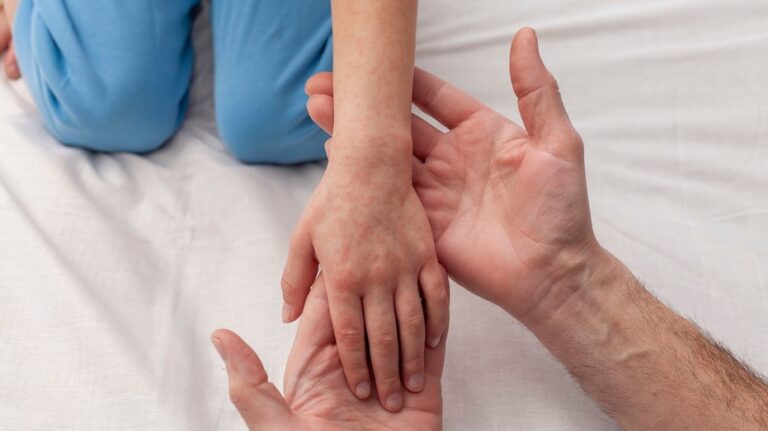 В Южной Каролине зафиксирована масштабная вспышка кори, сотни жителей отправлены на карантин