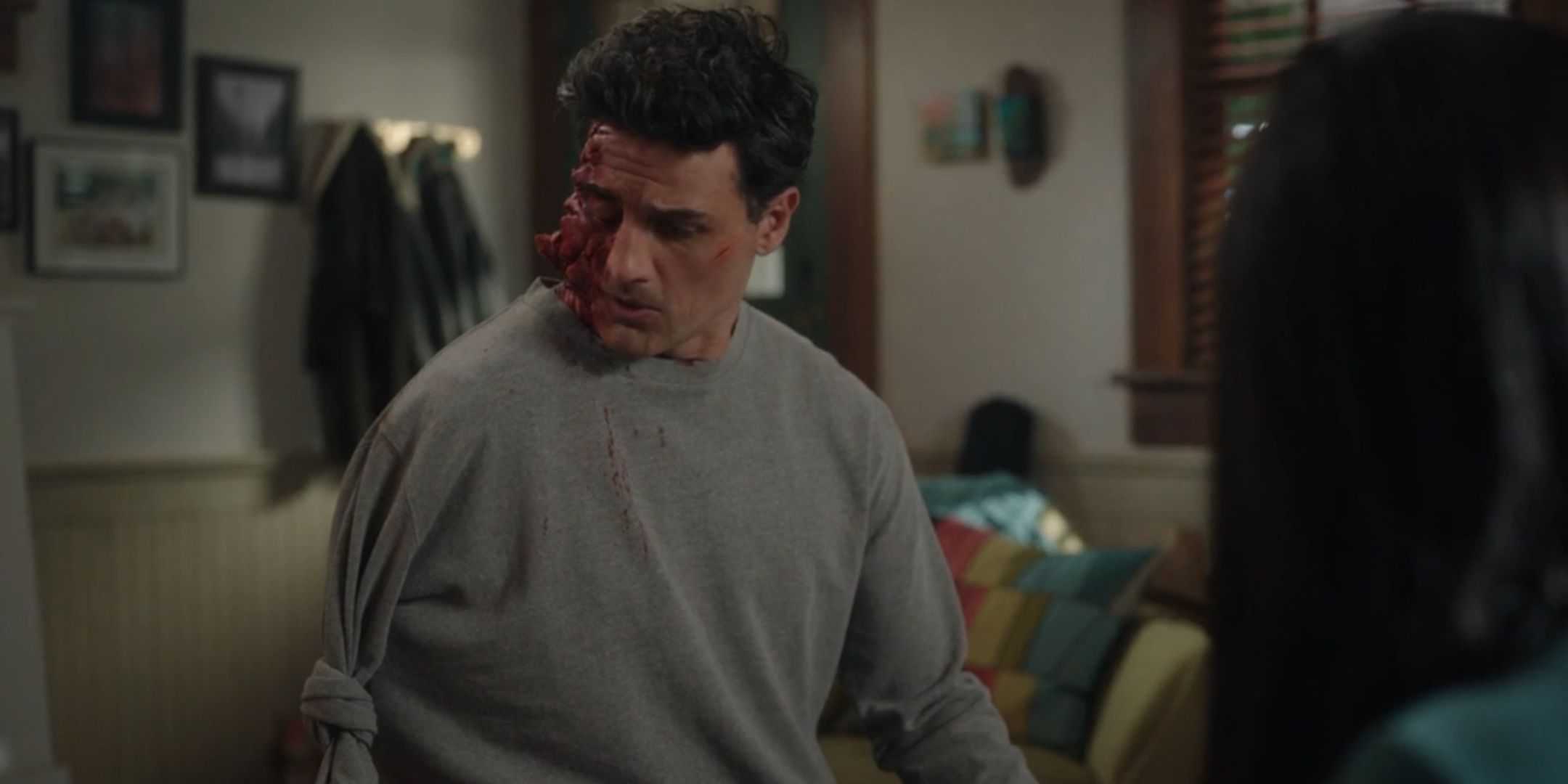 Энвер Джока как Джозеф в сериале "Resident Alien" с серьезными травмами лица