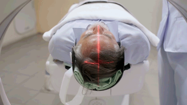 Новое исследование выявило связь между редким сосудистым заболеванием мозга и повышенным риском развития деменции у пожилых