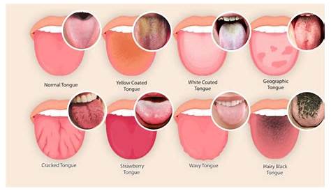 Как проглотить язык в футболе?мукиеле боится после того, как Red Bull Star проглотила трубку
