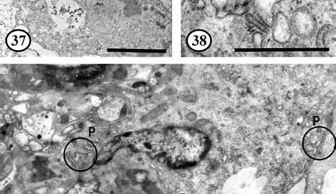 У слизней есть изображение поровой клетки в стенке сердца с Wnload