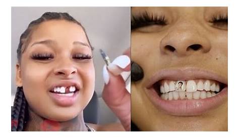 Как Крисеан потеряла зубной подкаст, который забил ей зуб?