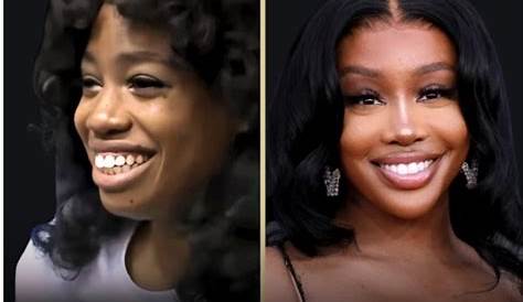 Сза получила поезд на Herregister Html Plstic Surgery История реля за ее дрмтическим Trnsformti