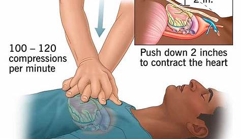 Какая роль команды отслеживает перебои и сжатия, которые невоспетые герои стоят за успешным Cpr Keep