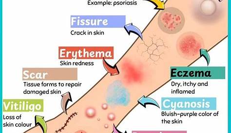 Смущающие истории экзаменов по коже Timeline Html Medical Assessment