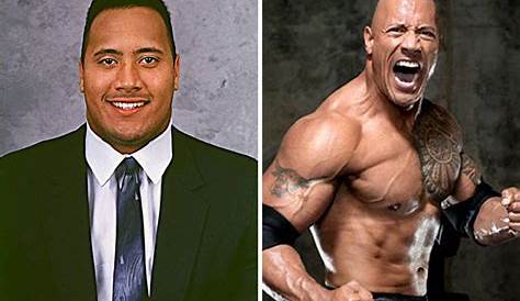 Скала без протезных групп передней линии лба до и после пластической хирургии фотографии являются завещанием для